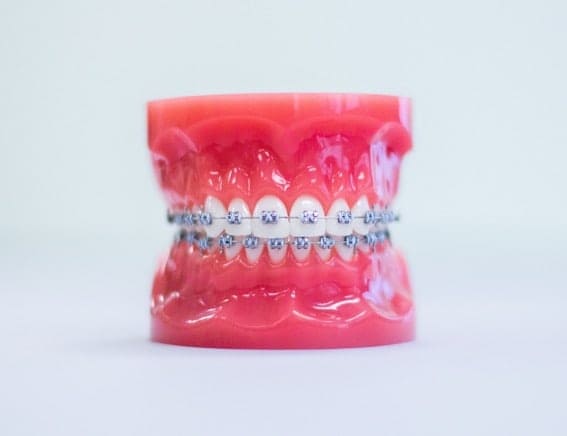 jupiter orthodontics
