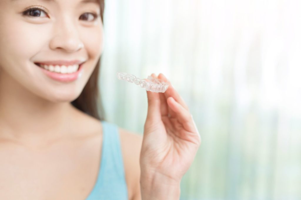 jupiter clear aligners